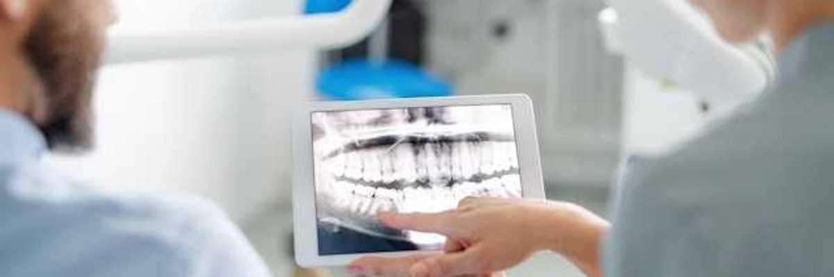 A dentist showing a patient his xrays
