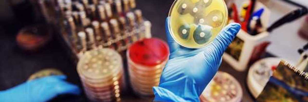 A gloved hand holding a petri dish