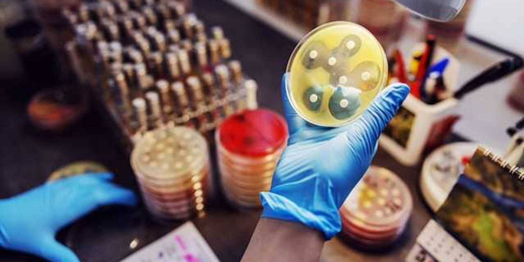 A gloved hand holding a petri dish