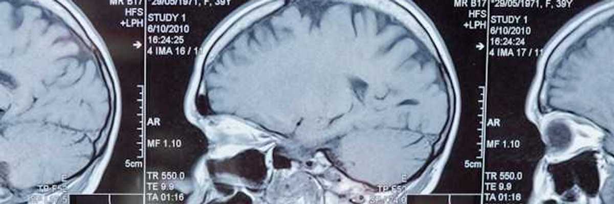 Closeup of a Magnetic Resonance Image (MRI)