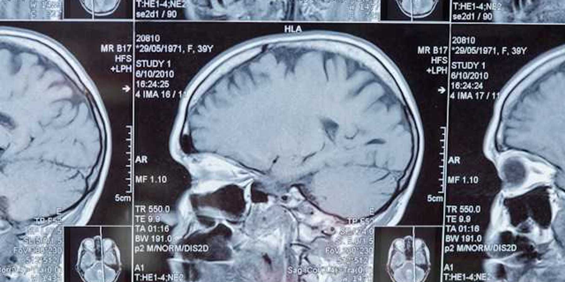 Closeup of a Magnetic Resonance Image (MRI)