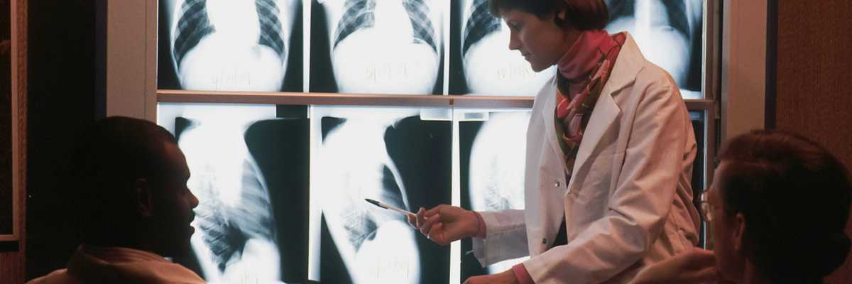 Doctors discussing chest xrays