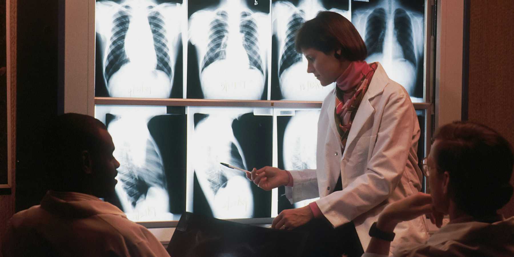 Doctors discussing chest xrays