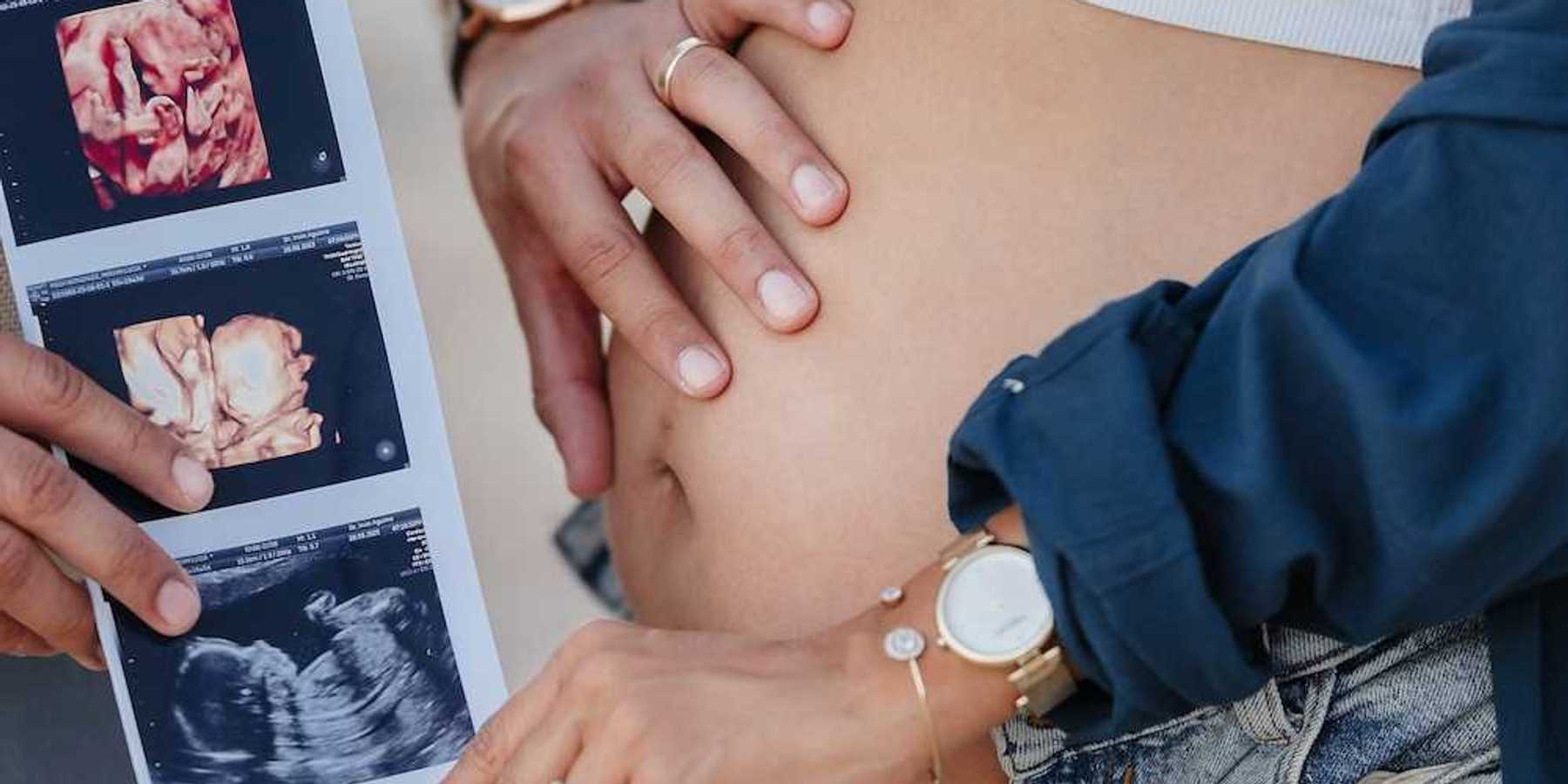 pregnant couple holding photos of baby in utero