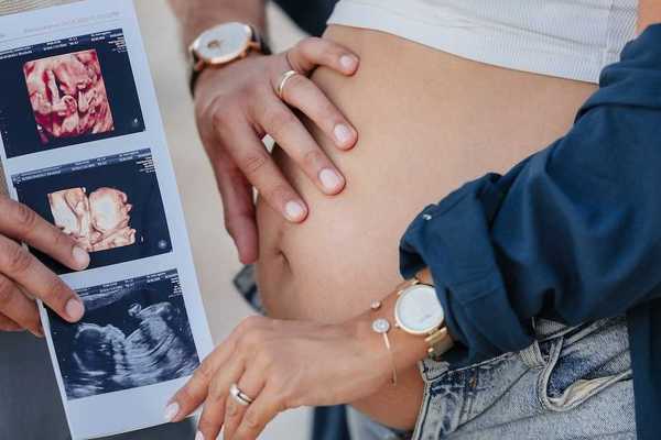 pregnant couple holding photos of baby in utero
