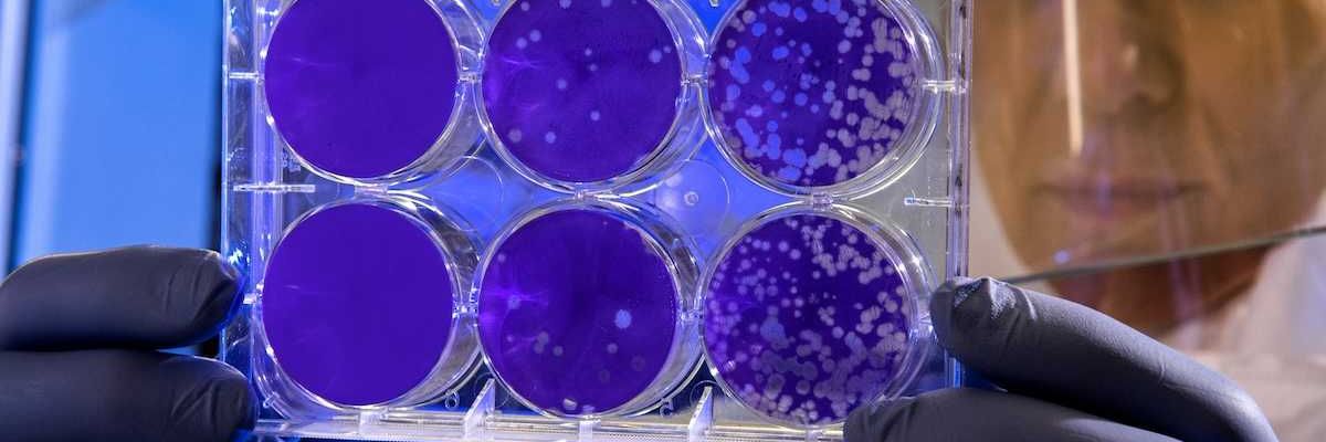 Scientist examines the result of a plaque assay, which is a test that allows scientists to count how many flu virus particles (virions) are in a mixture.
