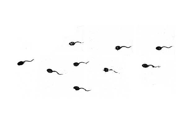 sperm count decline shanna swan