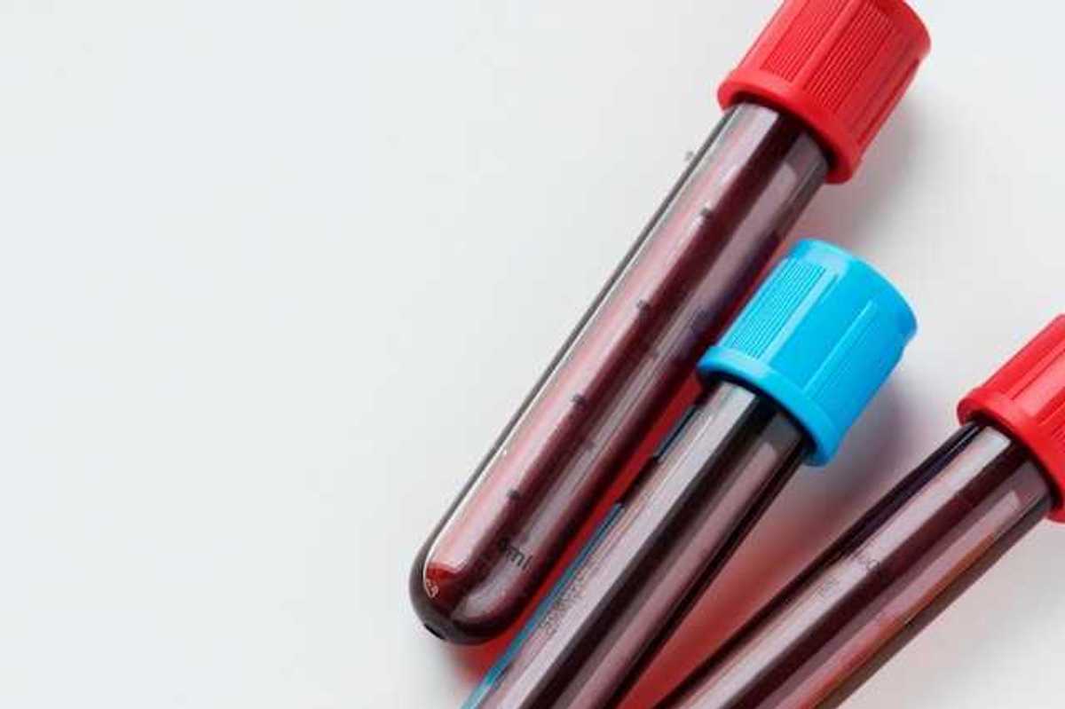 Three small vials of blood two with red caps and one with a blue cap
