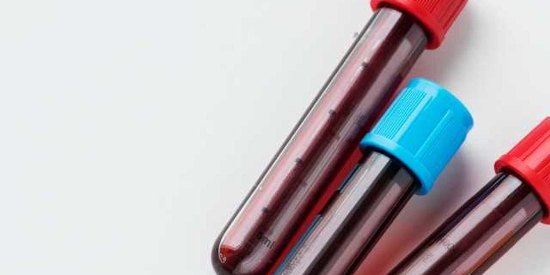 Three small vials of blood two with red caps and one with a blue cap