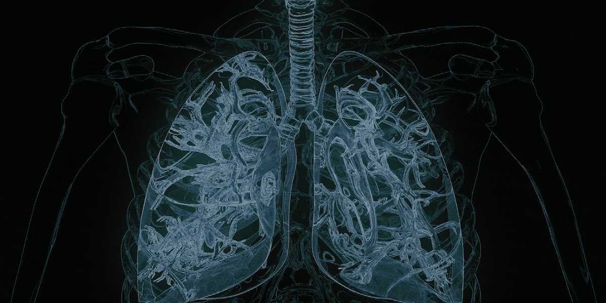 Xray with detailed view of lungs