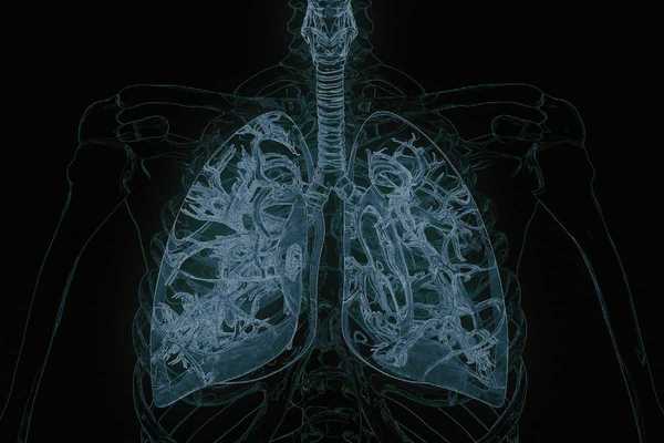 Xray with detailed view of lungs